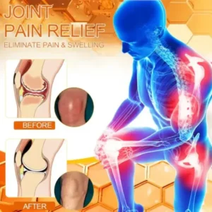 ADNOON™ Magnesium Oil & Bee Venom Joint Healing Spray Approved by the American Academy of Orthopaedic Surgeons (AAOS)
