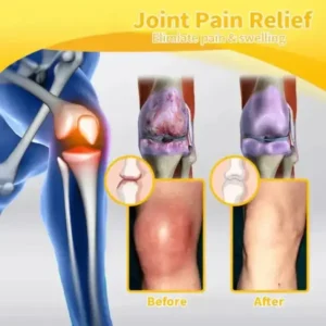 ADNOON™ Magnesium Oil & Bee Venom Joint Healing Spray Approved by the American Academy of Orthopaedic Surgeons (AAOS)