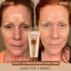 Zakdavi™ Radiant Whitening & Spot Eraser Mask