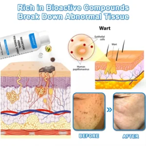 ✅Official Store: Zakdavi™ Magnesium Herbal Psoriasis Spray – FDA Certified Relief for Psoriasis, Eczema & Skin Tags