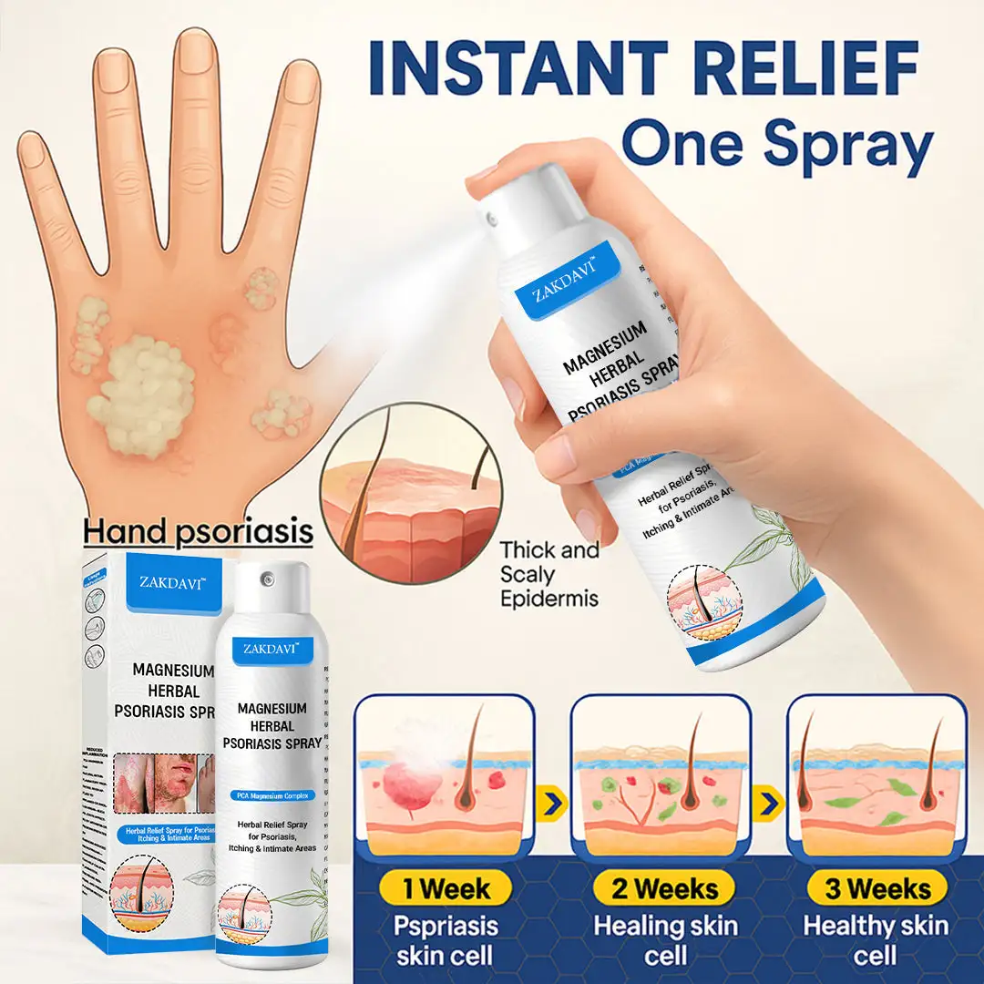 ✅Official Store: Zakdavi™ Magnesium Herbal Psoriasis Spray – FDA Certified Relief for Psoriasis, Eczema & Skin Tags