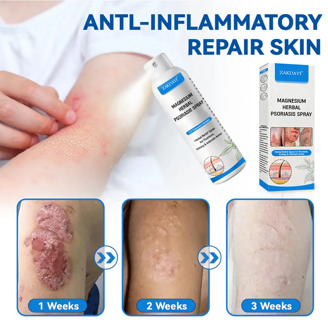 ✅Official Store: Zakdavi™ Magnesium Herbal Psoriasis Spray – FDA Certified Relief for Psoriasis, Eczema & Skin Tags