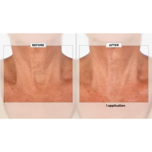 Zakdavi™ Patented Exclusive Smooth Body Butter