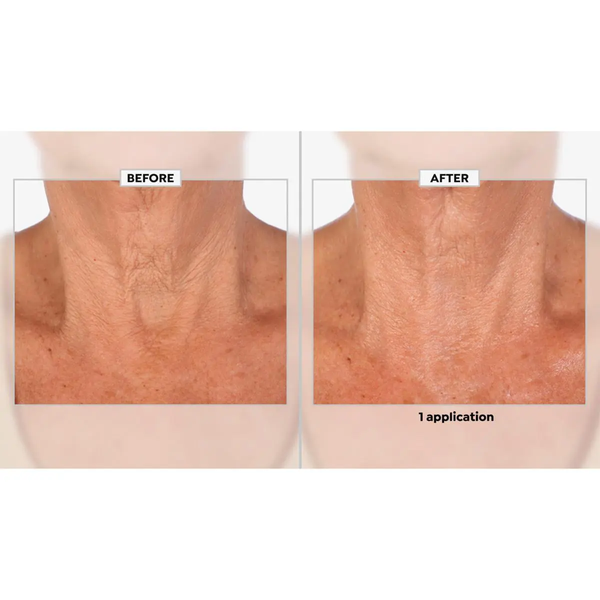 Zakdavi™ Patented Exclusive Smooth Body Butter